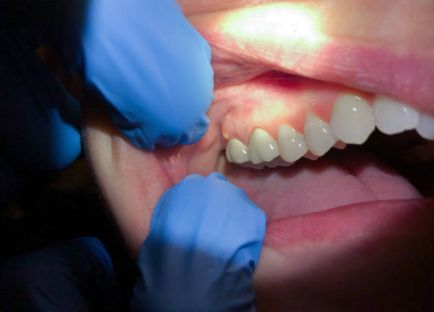 Best 24-Hour Emergency Dentist in Enigma, GA