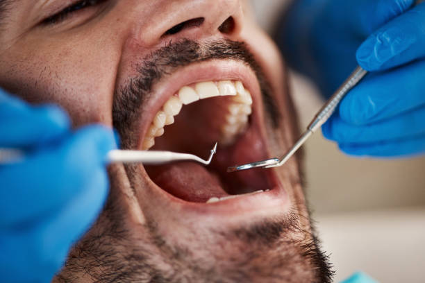 Best Emergency Treatment for Toothache in Enigma, GA