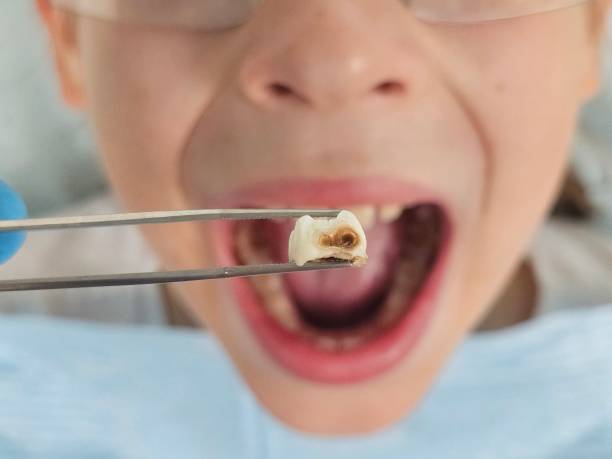 Best Emergency Treatment for Toothache in Enigma, GA